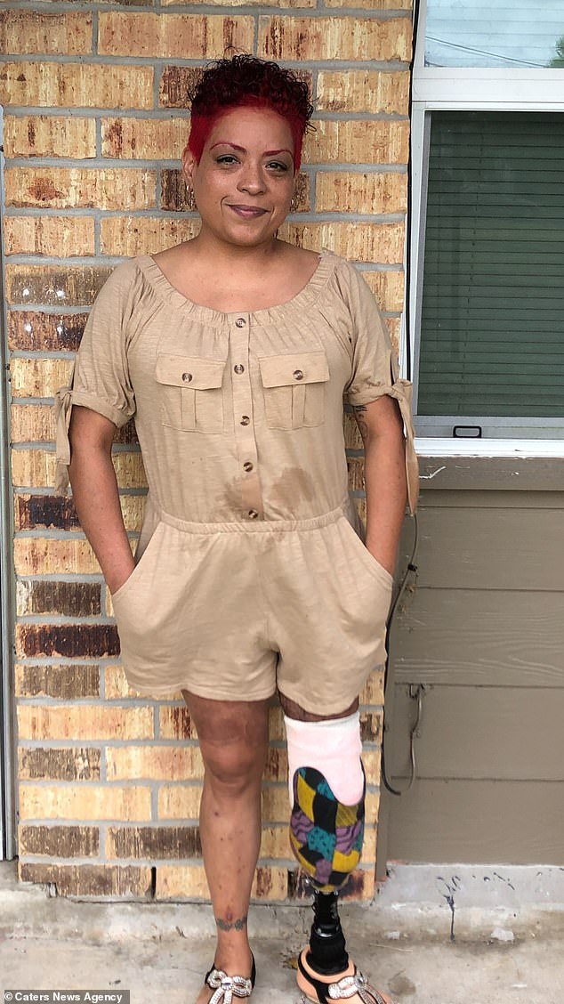 Bridgette pictured with her new leg says the pimple on her bum wasnt 