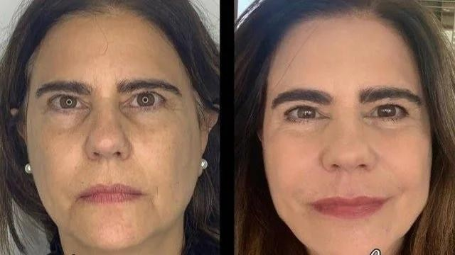 Antes e depois de Mayara Magri Foto Reproduo
