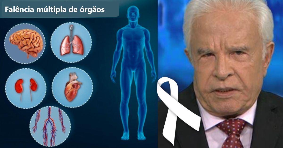 Falência múltipla dos órgãos: O que é e quais são os sintomas da ...