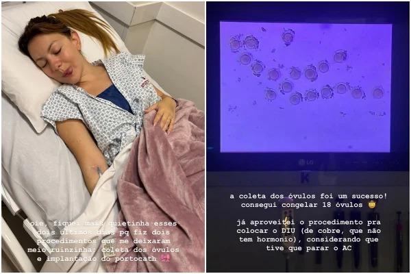 Bruna Furlan de Nbrega ReproduoInstagram