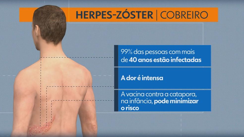 Herpes-zster Foto TV GloboReproduo